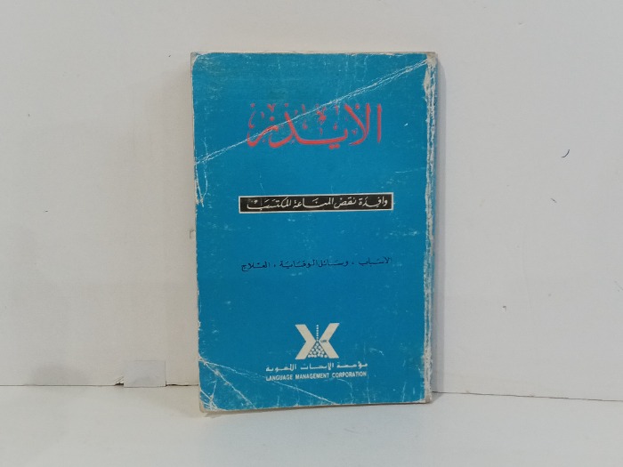 الايدز