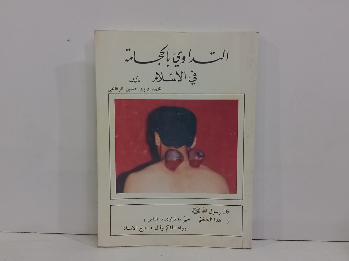 التداوي بالحجامة في الاسلام