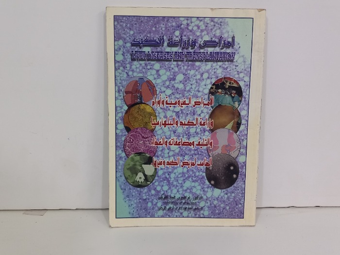 امراض وزراعة الكبد