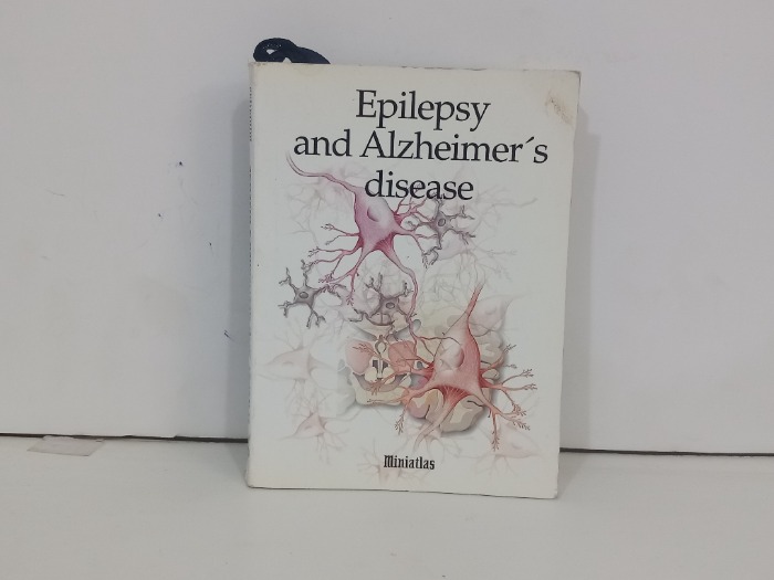 Epilepsy and Alzheimer s disease