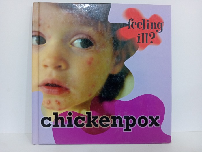 chickenpox