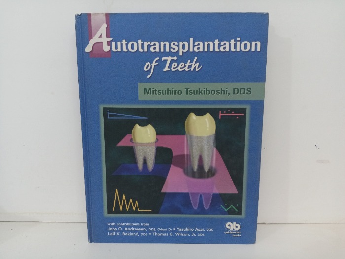 Autotransplantation of Teeth