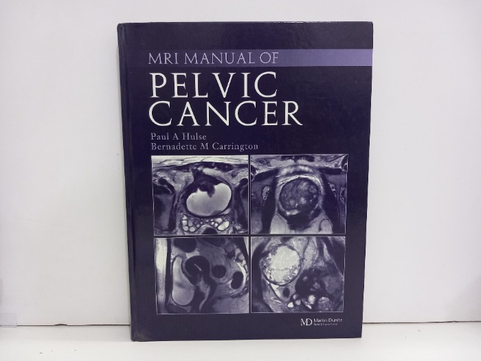 PELVIC CANCER