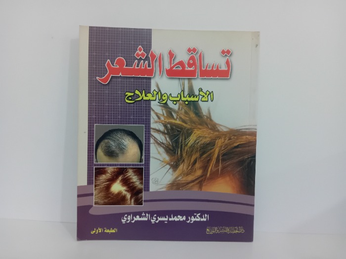 تساقط الشعر الاسباب والعلاح