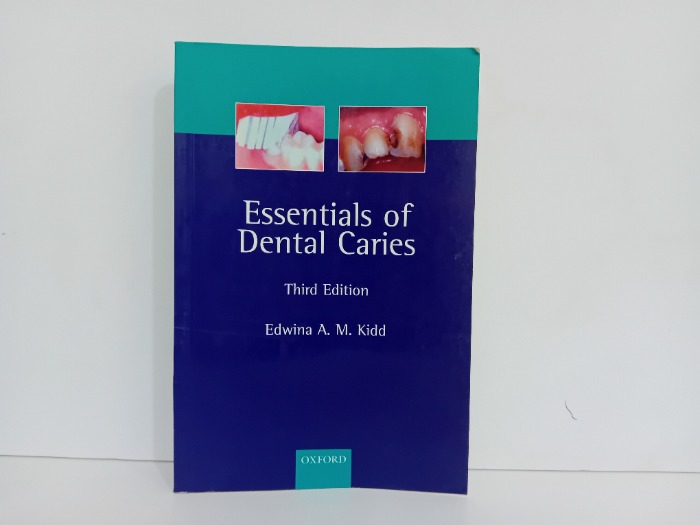 Essentials of Dental Caries