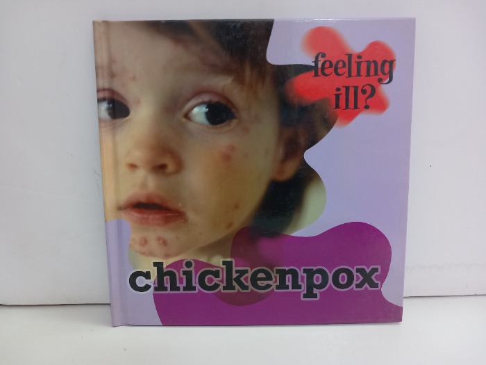 Chickenpox